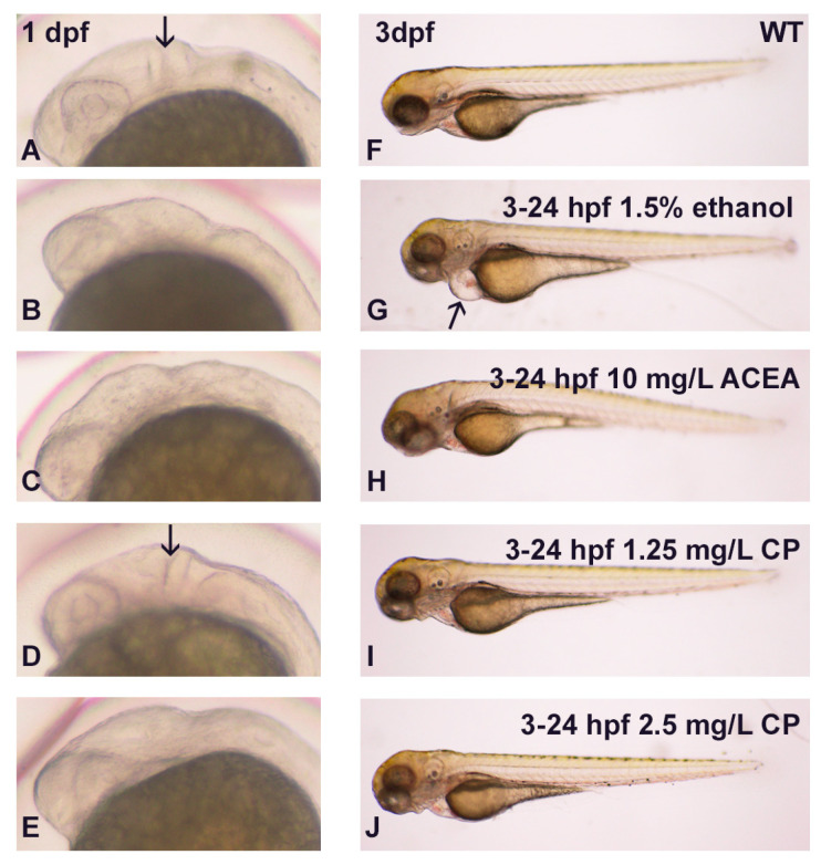 The effects of ethanol and cannabinoids on MHB and cardiac development. (A–E), MHB development was disrupted with 3–24 hpf 1.5% ethanol or 10 mg/L ACEA or 2.5 mg/L CP exposure (B,C,E), but not with 1.25 mg/L CP exposure ((D), arrow). (F–J), Obvious pericardial edema was only observed with exposure to 1.5% ethanol ((G), arrow), with no edema observed with any of the cannabinoid doses.