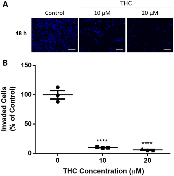 THC reduces HTR8/SVneo cell invasion. HTR8/SVneo cells were added to Matrigel-coated insert wells. The inserts were incubated for 48 h as described in “Methods”. (A) Representative immunofluorescent images of invaded HTR8/SVneo cells are shown, with the nuclei staining blue, magnification × 200 and scale bar indicates 100 µm (Nikon Eclipse Ti-E). (B) A summary histogram reporting the percentage of invaded cells relative to the vehicle control group (methanol), each data point is shown, the horizontal lines represent the means and the error bars represent SEM (n = 3). Significant differences were determined by a one-way ANOVA, followed by a Bonferroni post hoc test. **** P < 0.0001 (B).