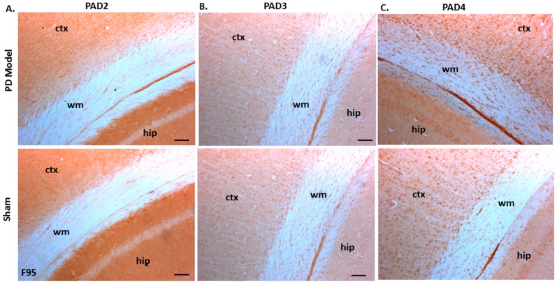 PAD2, PAD3, and PAD4 protein detection in pre-motor PD model and sham brain tissue. (A) PAD2 protein detection in cortex (ctx), white matter (wm) and hippocampus (hip) of sham and pre-motor PD models. (B) PAD3 protein detection in cortex, white matter, and hippocampus of shams and pre-motor PD rats. (C) PAD4 protein detection in cortex, white matter and hippocampus of shams and pre-motor PD rats. The scale bars indicate 100 µm in all figures (ctx = cortex, hip = hippocampus, wm = white matter).