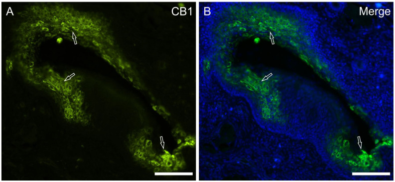 Photomicrographs showing a cryosection of the piglet papilla foliata in which anti-CB1 receptor antibody was applied (A). CB1 receptor immunoreactivity was observed, in all the papillae foliatae analyzed, in the clusters of the epithelial cells located in proximity to the crypts (arrows). (B): merged image. Scale bar: 50 µm.