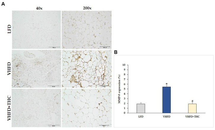 Effect of THC on MMP-9 expression: (A) representative MMP-9 expression; left column, magnification 40×; scale bar = 500 μm; right column, magnification 200×; scale bar = 100 μm; (B) % MMP-9 expression. Data are presented as mean ± SEM. *p < 0.001 vs. LFD group; #p < 0.001 vs. VHFD group.