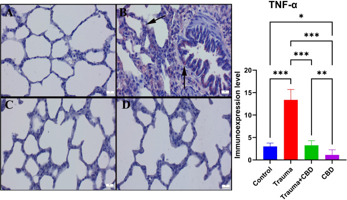 Comparison of TNF-α immunoexpression in the lungs between the groups. (A) Negative expression in the Sham group. (B) A marked increase in expression (arrows) of TNF-α staining was detected in the Trauma group. (C) Decreased expression (arrow) in the Trauma + CBD group. (D) No immunoreaction occurred in the CBD group. Streptavidin-biotin peroxidase method; scale bars = 20 μm. Statistical analysis of immunohistochemical values performed with One-way ANOVA (post-hoc Tukey). Values are presented as means ± SD. TNF-α: Tumor necrosis factor alpha, *p < 0.05 **p < 0.01 ***p < 0.001, Error bars represent standard deviation