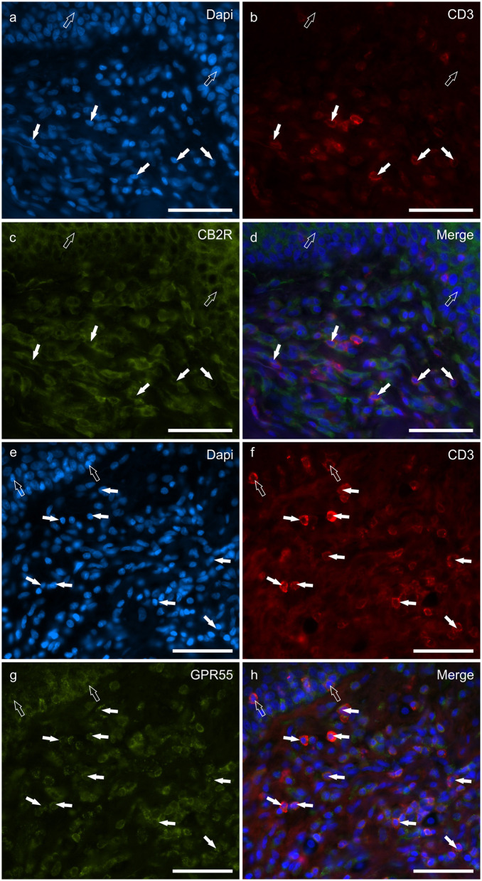 Photomicrographs of the cryosections of the skin of dogs with atopic dermatitis (AD) showing CD3 immunoreactive T lymphocytes expressing cannabinoid receptor 2- (CB2R) (a–d) and G-protein coupled receptor 55- (GPR55) (e–h) immunoreactivity (IR) (e–h). (a–d) The white arrows indicate the Dapi-labeled nuclei of some CD3 immunoreactive T lymphocytes co-expressing CB2R-IR. The open arrows indicate the nuclei of the keratinocytes expressing CB2R-IR (c). (e–h) The white arrows indicate the dapi-labeled nuclei of some CD3 immunoreactive T lymphocytes co-expressing GPR55-IR (g). The open arrows indicate the nuclei of two intraepithelial T lymphocytes co-expressing CD3- (f) and GPR55-IR (g). Bar: 50 μm.