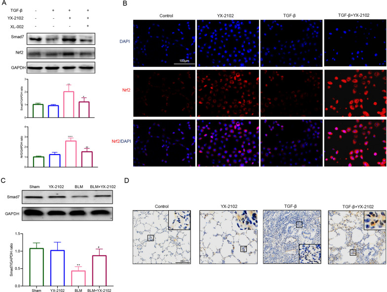 YX-2102 enhanced Nrf2-Smad7 pathway activation in A549 cells. A549 cells pretreated with YX-2102 (5.0 µM), with or without 5 µM XL-002 (a CB2R antagonist) for 2 h, were subjected to TGF-β1 stimulation (5 ng/mL) for another 24 h. A Western blot analyses of Smad7 and Nrf2 expression. B Immunofluorescence analysis of Nrf2 (red). Nuclei were counter-stained with DAPI (blue). Scale bar = 100 μm. C Western blot analyses of Smad7 expression. D Immunohistochemical analysis of Smad7 expression in the lungs of 21-day-old rats (magnification ×200). Large boxes are magnified views of the small boxes. Scale bar = 200 μm. Data are expressed as mean ± SEM of three independent experiments