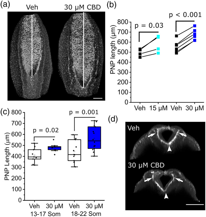 CBD diminishes closure of the spinal NT. (a) Representative 3D projections showing F‐actin labeled PNPs of a vehicle and littermate CBD‐treated embryos. Vertical lines indicate PNP length. (b) Quantification of PNP length. Points represent the mean of 3–4 embryos per condition and lines connect paired points from the same litter. (c) Quantification of PNP length in vehicle and 30 μM CBD treated embryos which reached the indicated somite stages at the end of culture in. Points represent individual embryos. (d) Optically resliced confocal images showing the median hinge point (arrow heads) and dorsolateral hinge points (arrows) in the PNP of a vehicle and littermate CBD‐treated embryo. Scale bars = 100 μm. CBD, Cannabidiol; NT, neural tube; PNP, posterior neuropore