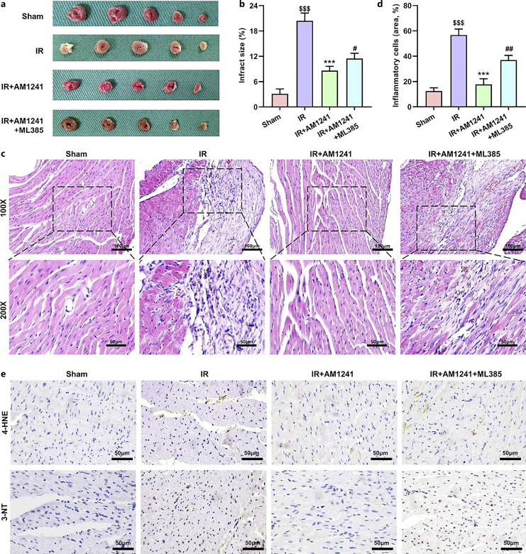 AM1241 alleviated myocardial infarct of rats with MIRI. a Representative images of TTC staining. b The percentage of infarct volume to left ventricular volume. c Myocardial tissues of normal rats and IR rats stained by H&E (×100, ×200). d Quantitative analysis of the number of inflammatory cells. e Immunohistochemical staining for 4-HNE and 3-NT was performed at ×200 magnification, with a scale bar of 50 μm. $$$p < 0.001 versus sham group; ***p < 0.001 versus IR group; #p < 0.05 and ##p < 0.01 versus IR + AM1241 group.