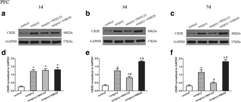 Surgery resulted in an increased expression of CB2R in the prefrontal cortex. JWH133 treatment alleviated the surgery-induced upregulation of CB2R in the prefrontal cortex, while AM630 aggravated it. Representative Western blotting bands show the expression of the CB2R in the prefrontal cortex 1, 3, and 7 days after surgery (a–c). The expression of CB2R was normalized to that of GAPDH as an internal control (d–f). The data are plotted as the mean ± standard error of the mean for each group (n = 3 per group). *p < 0.05 versus the control group, # p < 0.05 versus the surgery group