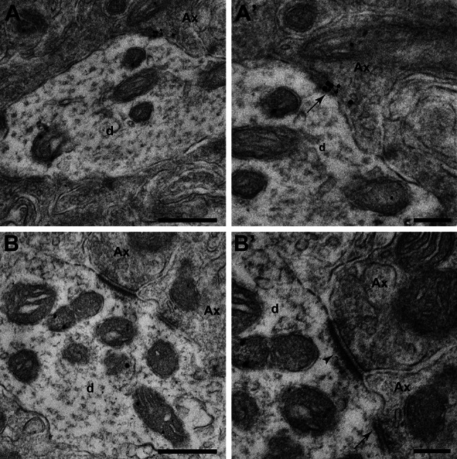Ultrastructural localization of CB1R–CB2R heteromers in the GPe (a, a’) and GPi (b, b’) nuclei using the PLA technique. a, a’ Electron micrograph showing CB1R–CB2R heteromers located in the pre- (Ax) and postsynaptic elements (d) in GPe. (a’) Inset taken from (a) at higher magnification showing that cannabinoid receptor heteromers are found in both the pre- and postsynaptic membranes in a symmetric synapse (arrow). b, b’ At the level of the GPi nucleus, cannabinoid receptor heteromers are confined to postsynaptic locations (d). (b’) Inset taken from (b) at higher magnification showing a GPi dendrite (d) simultaneously receiving one symmetrical (arrow) and one asymmetrical synapses (arrowhead). Scale bar is 500 nm for panels a and b, and 200 nm for insets a' and b'