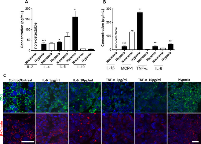 Cytokine production and the effect of exogenous cytokines. In A and B, two groups of 50 organoids each were pooled and cultured under hypoxic conditions and normoxic culture conditions for comparison. Total protein extract from 50 organoids was then pipetted into 6 wells for the ELISA. There was significantly higher secretion of IL-2, IL-4, and IL-8 under hypoxic condition compared to normoxic condition, however, IL-10 secretion was not different between the two culture conditions (A). The expression and secretion of inflammatory cytokines IL-1β, TNF-α, and IL-6 secretion was significantly elevated under hypoxic condition compared to normoxic conditions (B). MCP-1 secretion was significantly higher under hypoxic condition compared to normoxic conditions. In C, we highlight the effect of exogenous cytokines on the distribution of tight junction at the Blood-Brain Barrier. Normal distribution of the tight junctions is evident under normoxic condition while the tight junctions are disrupted when treated with both IL-6 and TNF-α at low or high concentrations. Similar disruption of the tight junction was also observed in organoids cultured under hypoxic condition. Student T-Test, two tailed hypothesis, n = 6 wells for A and B *P < 0.05, **P < 0.01, ***P < 0.001. Data represented as mean \documentclass[12pt]{minimal} \usepackage{amsmath} \usepackage{wasysym} \usepackage{amsfonts} \usepackage{amssymb} \usepackage{amsbsy} \usepackage{mathrsfs} \usepackage{upgreek} \setlength{\oddsidemargin}{-69pt} \begin{document}$$\pm \,{\rm{SEM}}$$\end{document}±SEM. Scale bars (control 40 μm, treated and hypoxia 40 μm).