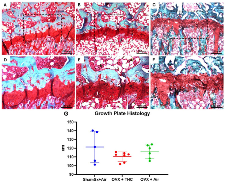 Growth plate histology. Photomicrographs of proximal tibial growth plates after stain with Safranin O/Fast Green.: (A) ShamSx + Air; (B) OVX + THC; (C) OVX + Air at low magnification (100×, scale bars = 200 µm); (D) ShamSx + Air; (E) OVX + THC; (F) OVX + Air at high magnification (200×, scale bars = 100 µm); (G) dot plots (mean line + SD) showing mean growth plate height (line) for each group. No significant differences were found between groups.