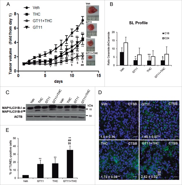 Pharmacological manipulation of the dihydroceramide content of cancer cells activates autophagy-mediated cell death in vivo and inhibits the growth of U87MG cell-derived xenografts. (A) Effect of THC (15 mg/kg; peritumoral administration), GT11 (7.5 mg/kg, peritumoral administration) or THC and GT11 on the growth of tumors generated by subcutaneous injection of U87MG cells. Data are expressed as mean fold increase ± SEM relative to d 1 (n = 6 for each experimental condition; **, P< 0.01 or *, P < 0.05 from vehicle-treated tumors; ##, P < 0.01 from THC-treated tumors and $, P < 0.05 from GT11-treated tumors). (B) Effect of THC (15 mg/kg), GT11 (7.5 mg/kg) or THC and GT11 on the ceramide:dihydroceramide ratio of tumors generated with U87MG cells. (n = 3; **, P < 0.01 or *, P < 0.05 from vehicle-treated tumors). (C) Effect of THC (15 mg/kg), GT11 (7,5 mg/kg) or THC and GT11 on autophagy (as determined by MAP1LC3B lipidation). Western blot corresponds to the analysis of 2 different animals/tumors per experimental condition. (D) Effect of THC (15 mg/kg), GT11 (7.5 mg/kg) or THC and GT11 on CTSB immunostaining. Values in the lower left corner correspond to the CTSB-stained area relative to the number of nuclei in each field; these correspond to 10 fields of 3 different tumors for each condition and are expressed as the mean fold change ± s.d. **, P < 0.01 from vehicle-treated tumors; ##, P < 0.01 from GT11-treated tumors and from THC-treated tumors. Representative images from each experimental condition are shown. Bar: 20 μm. (E) Effect of THC (15 mg/kg), GT11 (7.5 mg/kg) or THC and GT11 on apoptosis (as determined by TUNEL). Bars indicate the percentage of TUNEL-positive cells relative to the number of nuclei in each field and correspond to 10 fields of 3 different tumors for each condition and are expressed as the mean fold change ± s.d. **, P < 0.01 from vehicle-treated tumors ##, P < 0.01 from GT11-treated tumors and from THC-treated tumors.