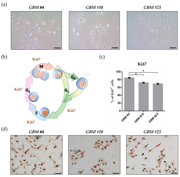 Morphological features and Ki67 immunoreaction of patient-derived glioblastoma (GBM) cells. (a) Representative light microscope images of the cell morphology of GBM #4, GBM #10, and GBM #23. Scale bar = 50 µm. (b) Schematic overview showing the presence of Ki67 during the cell cycle. Ki67 is located in the nucleus and is detectable during the whole cell cycle (G1-, S-, G2-, and M-phase), except for the G0-phase. (c) Graph indicates the percentage of GBM cells showing Ki67 positivity (Ki67+). Patient-derived GBM cells exhibited different and high numbers of Ki67-labbelled cells. Their percentage was as follows: 84.73% ± 1.11% (GBM #4, n = 34), 72.12% ± 1.18% (GBM #10, n = 32), and 69.42% ± 1.44% (GBM #23, n = 22). Data are means ± SEM of all untreated control groups of this study. Significance was chosen for p < 0.05. The asterisk denotes significant results regarding the respective measurement indicated with the bar. (d) Representative images of Ki67-stained GBM #4, GBM #10, and GBM #23. Brown staining represents Ki67+ cells (red arrows) and blue staining Ki67- cells (black arrows). Nuclei were counterstained using hematoxylin. The number of values is represented by n. Scale bar = 75 µm.