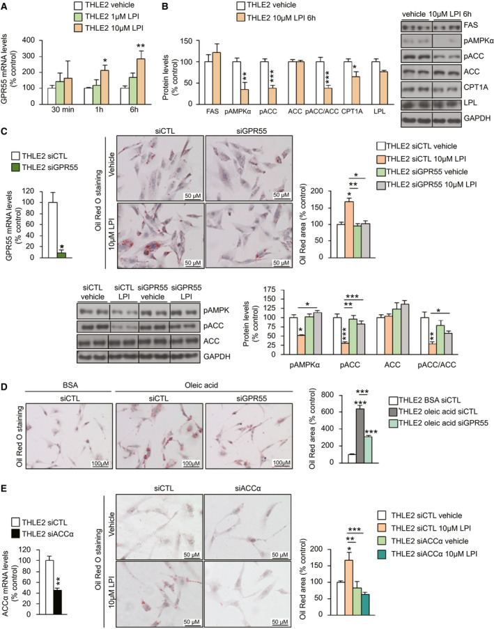 GPR55 regulates lipid accumulation in human hepatocytes through pACC. (A) GPR55 mRNA in THLE2 hepatic cells treated with different doses of LPI (n = 6) (B) Protein levels of markers of lipid metabolism in cells following administration of 10 µM LPI for 6 hours (n = 6). (C) mRNA levels of GPR55 in THLE2 cells transfected with siGPR55 or siCTL for 48 hours (n = 3 per group). Oil Red O staining of THLE2 cells after silencing GPR55, treated with vehicle or LPI. Lipids were quantified and normalized to the total number of nuclei per field (n = 6). Protein levels of pAMPKα, pACC, and ACC were measured (n = 5‐6). (D) Oil Red O staining in THLE2 cells cultured in oleic acid (1 mM) after the down‐regulation of GPR55 (n = 6). (E) mRNA levels of ACCα in THLE2 cells transfected with siACCα or siCTL for 48 hours (n = 5‐6). Oil Red O staining of THLE2 cells after silencing ACCα, treated with vehicle or LPI (n = 6). GAPDH and HPRT were used to normalize protein and mRNA levels. Dividing lines indicate splicing in the same gel. Data are presented as mean ± SEM. Statistical differences are denoted by *P < 0.05, **P < 0.01, and ***P < 0.001. Abbreviations: ACC, acetyl–coenzyme A carboxylase; BSA, bovine serum albumin; CPT1a, carnitine palmitoyl transferase 1a; FAS, Fas cell‐surface death receptor; GAPDH, glyceraldehyde 3‐phosphate dehydrogenase; GPR55, G protein–coupled receptor 55; HPRT, hypoxanthine‐guanine phosphoribosyltransferase; LPI, l‐α‐lysophosphatidylinositol; LPL, lipoprotein lipase; pACC, phosphorylated ACC; pAMPKα, phosphorylated adenosine monophosphate–activated protein kinase α; siACCα, small interfering RNA ACCα; siCTL, small interfering RNA control; siGPR55, small interfering RNA GPR55.