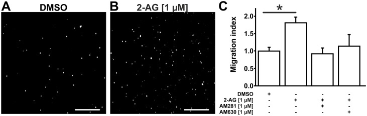 2-AG promotes B6MCL macrophage migration as assessed by modified Boyden chamber experiments.B6MCL macrophage migration was assessed by modified Boyden chamber experiments. 350,000 cells were seeded per well and allowed to migrate for 90 minutes. Cells adherent to the lower side of the polycarbonate membrane were counted automatically using Image J 1.48v software following DAPI staining. Addition of 2-AG [1 μM] to the lower chamber resulted in an increased migration of B6MCL macrophages (B) compared to DMSO (A). This effect was blunted by addition of CB1-inhibitor AM281 [1 μM] and by CB2-inhibitor AM630 [1 μM] (C). Data are presented as mean ± standard error of the mean; n = 4–6; *, p < 0.05, assessed by ANOVA and Bonferroni correction. Scale bar, 300 μm. 2-AG, 2-arachidonoylglycerol; AM281, selective inhibitor of CB1; AM630, selective inhibitor of CB2; DMSO, dimethyl sulfoxide.