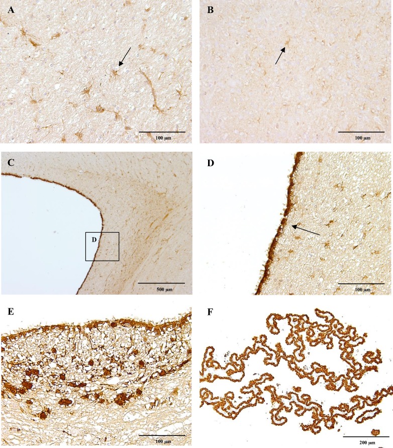 CB1 immunoreactivity.Astrocytes (arrow) of the cerebral white matter of a six-month-old Beagle dog showing strong CB1 receptor immunoreactivity (A) comparing to astrocytes of a four-week-old dog, which are only slightly positive (B). The ependymal cells (arrow) of a six-month-old dog lining the lateral ventricle strongly express CB1 receptor (C, D). Similarly, ependymal cells lining the fourth ventricle and scattered neuroglial cells (E) are CB1 receptor positive, as well as cells of the choroid plexus (F). IHC was performed using the avidin-biotin-peroxidase complex (ABC) method.