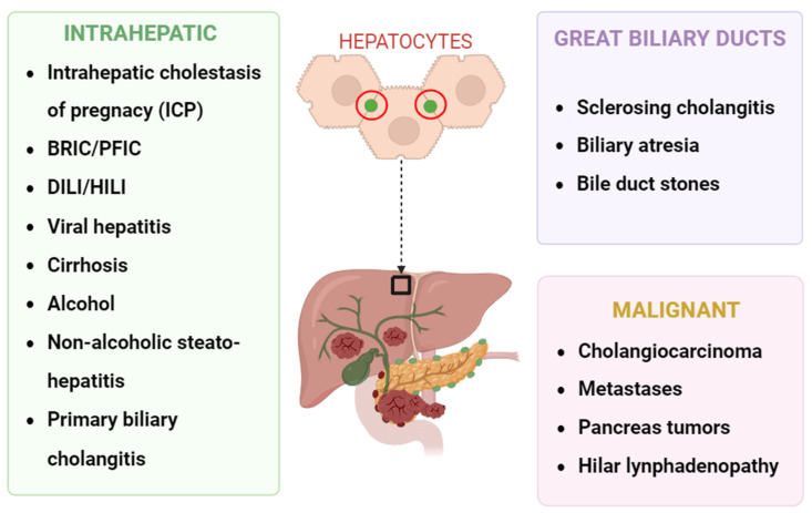 Most common causes of cholestatic pruritus. BRIC = benign recurrent intrahepatic cholestasis, PFIC = progressive familial intrahepatic cholestasis, DILI = drug-induced liver injury, HILI = herb-induced liver injury. Primary biliary cholangitis (PBC) and primary sclerosing cholangitis (PSC) can present without abnormalities on cholangiography.