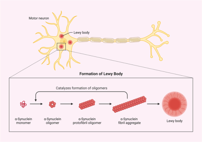 Formation of Lewy body from α‐synuclein. α‐Synuclein fibril aggregate from the monomeric form.