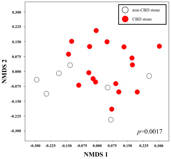 Analysis of similarity (ANOSIM). ANOSIM showed a significant difference between the metabolic profiles of bile samples from patients with or without CBD stones.