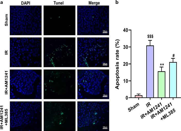 Myocardial cell apoptosis was repressed by AM1241. a Apoptosis of cardiomyocytes in each group was detected by TUNEL assay. b Myocardial cell apoptosis rate in each group. $$$p < 0.001 versus sham group; **p < 0.01 versus IR group; #p < 0.05 versus IR+AM1241 group.