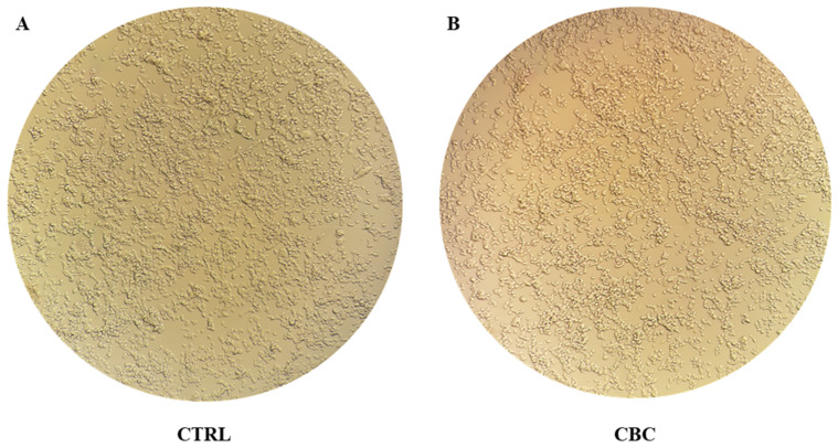 Pictures of the two groups 24 h after (A) completing fresh medium change (CTRL) and (B) 10 µM CBC treatment (CBC). No difference in cell density indicates that cells are not under stress or they did not undergo apoptosis during treatment, as suggested by the MTT test.