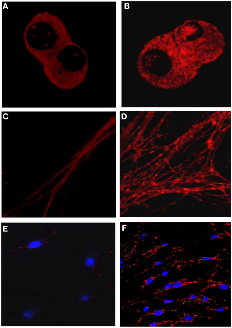 Detection of μOR-δOR heteromers in primary dorsal root ganglion neurons using heteromer-selective antibodies. (A–D) Primary dorsal root ganglion neurons (DRGs) from embryonic rats were treated without (A,C) or with 10 μ M morphine (B,D) for 48 h. μ OR-δ OR heteromers were visualized in the cell bodies (A,B) or in dendrites (B,D) using heteromer-selective antibodies (red). (E,F) Primary DRGs from adult rats were treated without (E) or with 10 μ M morphine (F) for 48 h and μ OR-δ OR heteromers visualized using heteromer-selective antibodies (red). Morphine treatment increases μ OR-δ OR heteromer levels. Blue color represents nuclear DAPI staining.