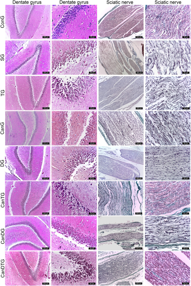 Microscopy panel showing histological sections of the dentate gyrus and sciatic nerve in eight experimental groups, with images at low and high magnification for each tissue type. Differences in cell density and fiber integrity are visible across groups.