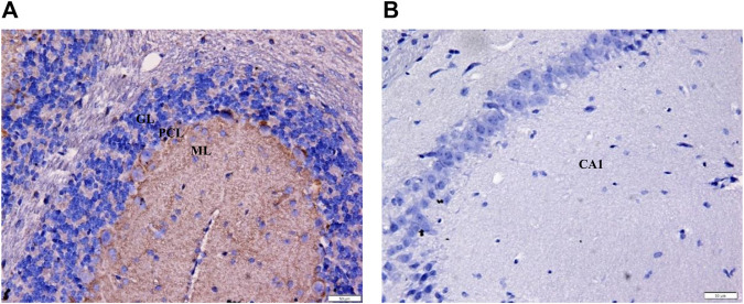 Immunohistochemistry of positive and negative controls at ×400 magnification to validate staining specificity. (A) Immunoreactive fibers within the mouse cerebellar molecular layer served as the positive control for CB1 receptor. The brown deposits confirm the presence of CB1 receptors (OD = 0.28). (B) No stain was detected in the neurons and surrounding fibers of the CA1 hippocampal region (negative control; OD = 0.00). GL = granular layer; PCL = Purkinje cell layer; ML = molecular layer; Bars = 50 µm.