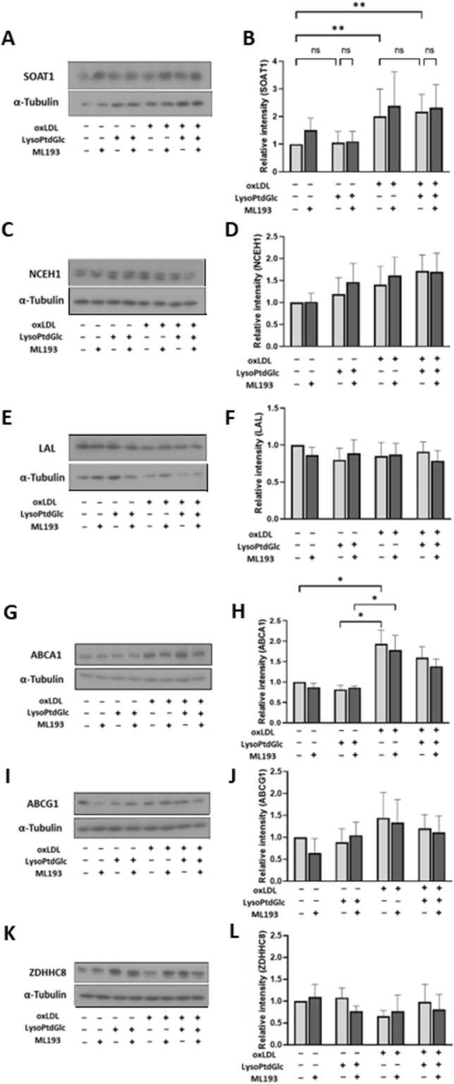 LysoPtdGlc/GPR55 signaling inhibits cholesterol efflux. (A–L) Expression of various proteins in M2c macrophages was quantified by Western blotting analysis. Representative blots of SOAT1 (A), NCEH1 (C), LAL (E), ABCA1 (G), ABCG1 (I), and ZDHHC8 (K) are shown. Relative band intensities were determined by densitometric analysis and normalized to α-tubulin (B, D, F, H, J, L). Data are presented as mean ± SEM from five independent experiments.