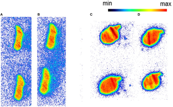 The autoradiography results obtained with 5 nM [11C]AAT-015 using spleen tissue sections. (A) Mouse spleen under baseline condition; (B) Mouse spleen under blockade conditions (10 μM GW405833); (C) Rat spleen under baseline conditions; (D) Rat spleen under blockade conditions (10 μM GW405833); n = 2.