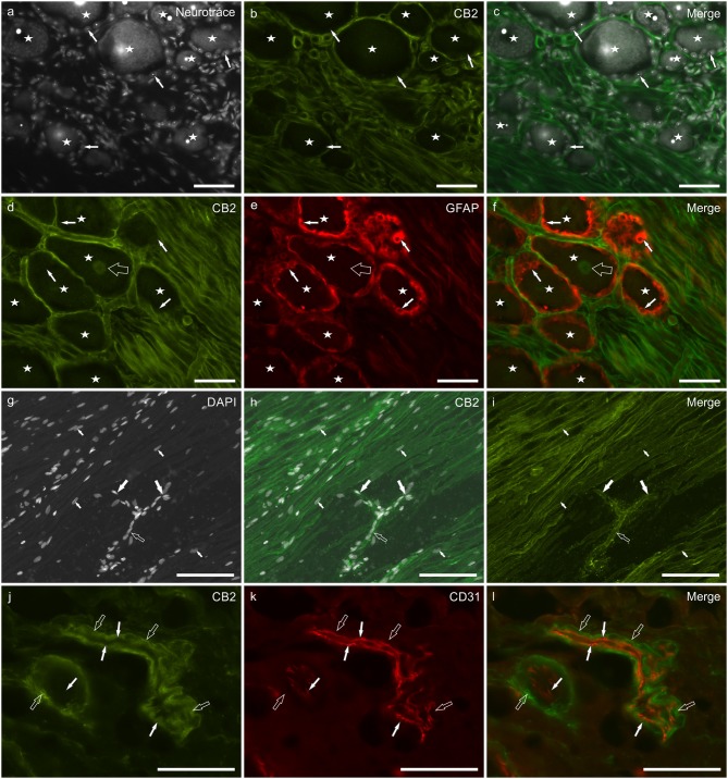 Photomicrographs of cryosections of canine cervical (C8) dorsal root ganglion showing cannabinoid receptor 2- (CB2), glial fibrillary acidic protein- (GFAP), and CD31-immunoreactivity. (a–c) Stars indicate NeuroTrace labeled (a) dorsal root ganglion sensory neurons which were CB2 receptor negative (b), as well as the satellite glial cells (white arrows). (d–f) Stars indicate sensory neurons encircled by satellite glial cells (white arrows) which were GFAP-immunoreactive (e) and CB2 receptor negative. CB2 receptor immunoreactivity was expressed by Schwann cells and neuronal nuclei (open arrow). (g–i) The empty arrow indicates one neuronal axon that bifurcates (T-junction) in its central and peripheral portions (large white arrows). The small arrows indicate the nuclei of Schwann cells. (j–l) Open arrows indicate smooth muscle cells (vessel on the left) and pericyte-like cells (elongated and thin blood vessel on the right) showing CB2 receptor immunoreactivity (j). White arrows indicate endothelial cells showing CD31 immunoreactivity (k). Bar: a–f, j–l = 50 μm; g–i = 100 μm.