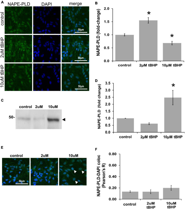 Expression of N-acyl phosphatidylethanolamine phospholipase D (NAPE-PLD) in ReN cells under conditions of oxidative stress. (A) ReN cells express NAPE-PLD in the soma and nucleus. (B) Exposure of ReN cells to tert-butylhydroperoxide (tBHP) resulted in a biphasic NAPE-PLD expression pattern–2 μM tBHP led to a 20% increase in NAPE-PLD expression. Green fluorescence is NAPE-PLD and blue fluorescence is DAPI. (C,D) Western blot analysis reveals that the expression of a 48 kDa band (expected molecular weight is 45.6 kDa) corresponding to NAPE-PLD is upregulated 2.4-fold by exposure to 10 μM tBHP. (E,F) Colocalization analysis on image stacks reveals that there is little colocalization between NAPE-PLD and DAPI (Pearson’s R value < 0.20) except for when cells are exposed to 10 μM tBHP, a concentration that increases colocalization to Pearson’s R of 0.20. *p ≤ 0.05.