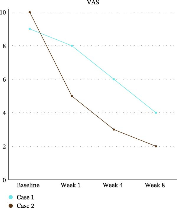 Longitudinal trajectory of pain intensity (VAS) in both cases from baseline through week 8. Both patients exhibited clinically meaningful reductions in pain scores over time, consistent with improved somatosensory function and quality‐of‐life outcomes.