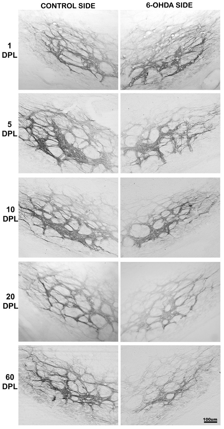 Temporal changes of CB1 expression in the IGP of PD-induced rats.CB1 expression in internal globus pallidus (IGP) of rats submitted to unilateral intrastriatal injections of 6-OHDA after 1, 5, 10, 20 and 60 days post-lesion (DPL). Digital images of coronal sections of the IGP show an increase in the CB1 expression in the experimental side at 1 DPL. From 5 to 60 DPL, there was a gradual decrease in the CB1 expression.