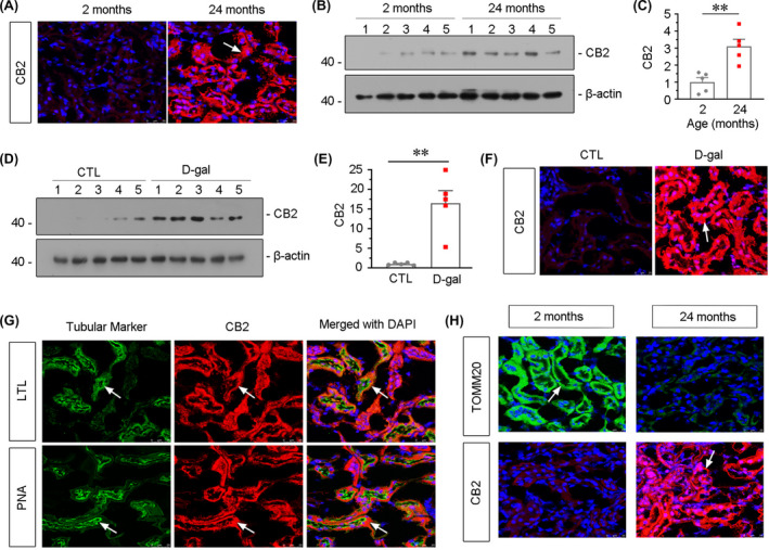 CB2 is upregulated in aged kidneys. (A) Representative micrographs showing CB2 expression in kidneys from 2‐month‐old and 24‐month‐old mice. Cryosections were subjected to fluorescence in situ hybridization (FISH) staining for CB2. Arrow indicates positive staining. scale bar, 25 μm. (B‐E) Representative Western blot and quantitative data showing renal expression of CB2 from 2‐month‐old and 24‐month‐old mice (B and C) or mice which were administered subcutaneous injections of d‐gal at 150mg/kg/day for 6 weeks (D and E). Numbers (1–5) indicate each individual animal in a given group. **p < 0.01 versus 2‐month‐old mice group or the sham control group (n = 5). (F) Representative images showing renal expression of CB2 in d‐gal‐treated mice. Cryosections were subjected to fluorescence in situ hybridization (FISH) staining for CB2. Arrow indicates positive staining. scale bar, 25 μm. (G) Representative micrographs showing the colocalization of CB2 and various segment‐specific tubular markers in kidneys. Frozen kidney sections were stained for CB2 (red) using FISH and various segment‐specific tubular markers (green) by immunofluorescence. The following segment‐specific tubular markers were used: proximal tubule, lotus tetragonolobus lectin (LTL); distal tubule, peanut agglutinin (PNA); arrows indicate positive tubules with colocalization of CB2 and specific tubular markers. Scale bar, 25 μm. (H) Representative micrographs showing the expression of CB2 and TOMM20 in tubules in 2‐month‐old and 24‐month‐old mice. Cryosections were subjected to FISH staining of CB2 (red) and stained with TOMM20 (green) antibody by immunofluorescence. Arrows indicate positive staining. Scale bar, 25μm