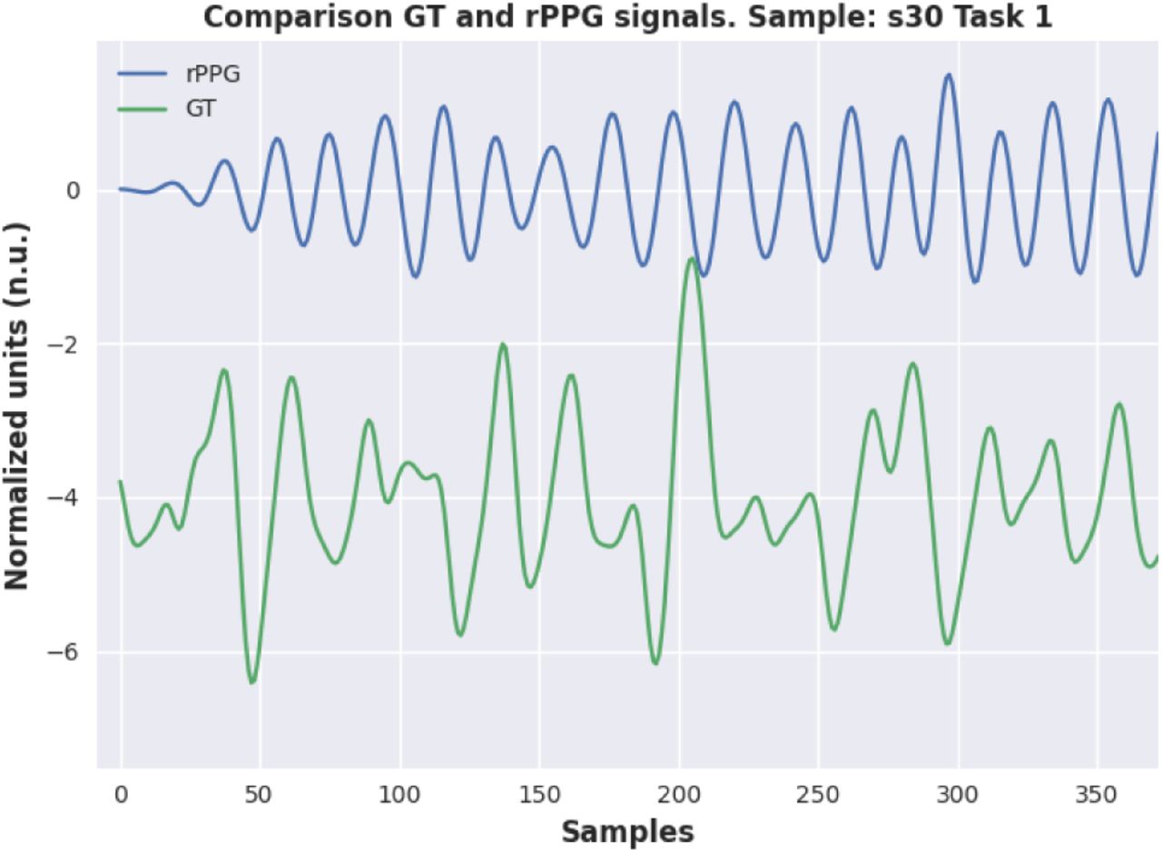 Example of the damaged signal.
