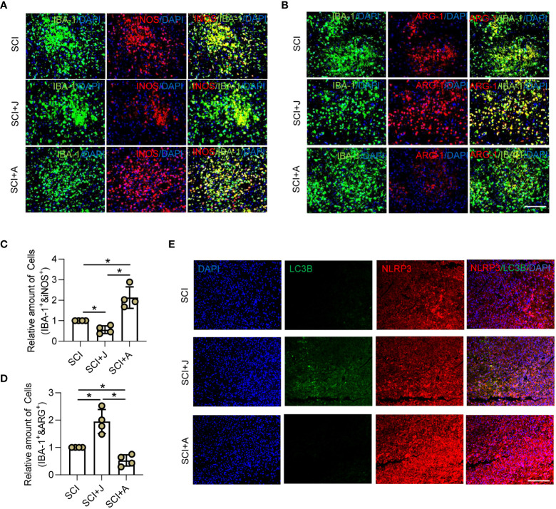 CB2R alleviated inflammation by promoting NLRP3-autophagosome formation in injured cords post-SCI. On day 3 post-SCI with CB2R activation by JWH-133 or inactivation by AM630, (A) IF staining of iNOS (red) and IBA-1 (green); (B) IF staining of ARG-1 (red) and IBA-1 (green). Scale bar = 100 μm. (C) Quantitative analysis of the number of iNOS+ microglia. (D) Quantitative analysis of the number of ARG-1+ microglia. (E) IF staining of NLRP3 (red) and LC3B (green) on day 3 post-SCI. Scale bar = 100 μm. * p < 0.05.