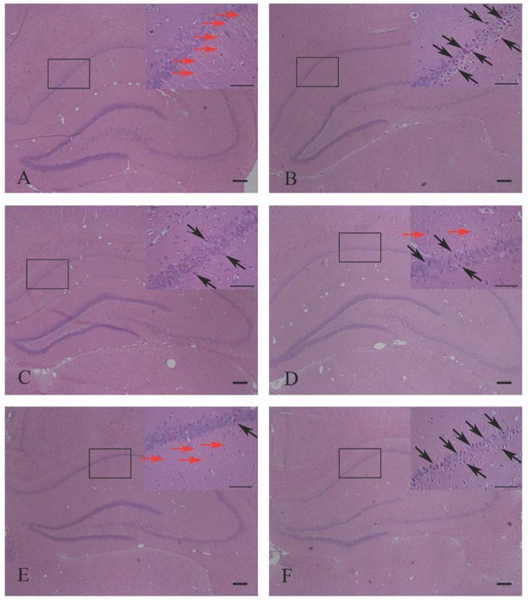 HE staining showed the effects of HPβCD/BCP on morphologic changes in hippocampal neurons caused by 2VO: sham group (A), 2VO group (B), HPβCD/BCP low dose group (C), HPβCD/BCP middle dose group (D), HPβCD/BCP high dose group (E), and AM630 group (F). In the 2VO group, neurons were paramorphia, their nuclei became triquetrous or polygonous, and the nerve fibers were fractured and reduced. In the HPβCD/BCP group, less abnormal neurons were observed. In the AM630 group, the neurons were triquetrous and wedge-shaped, the nuclei were irregular, the cytoplasm was aggregated and the nerve fibers were fractured and reduced. The red arrows showed the nerve fibers and the black arrows showed the abnormal neurons. The bar is 100 μm.