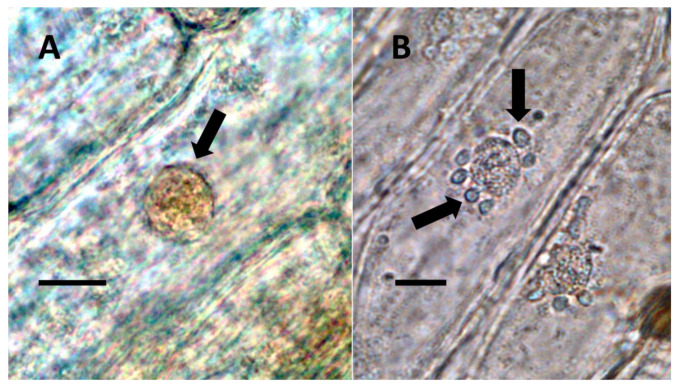 Nuclei showing internal bacteria (arrows). (A) Festuca rubra nucleus (arrow) stained for reducing sugars (orange color in nucleus) using copper sulfate (Bar = 10 µm). (B) Hosta plantaginea nuclei stained with acidified diphenylamine to show nitrate (blue-purple color) as bacteria exit the nucleus (Bar = 10 µm).
