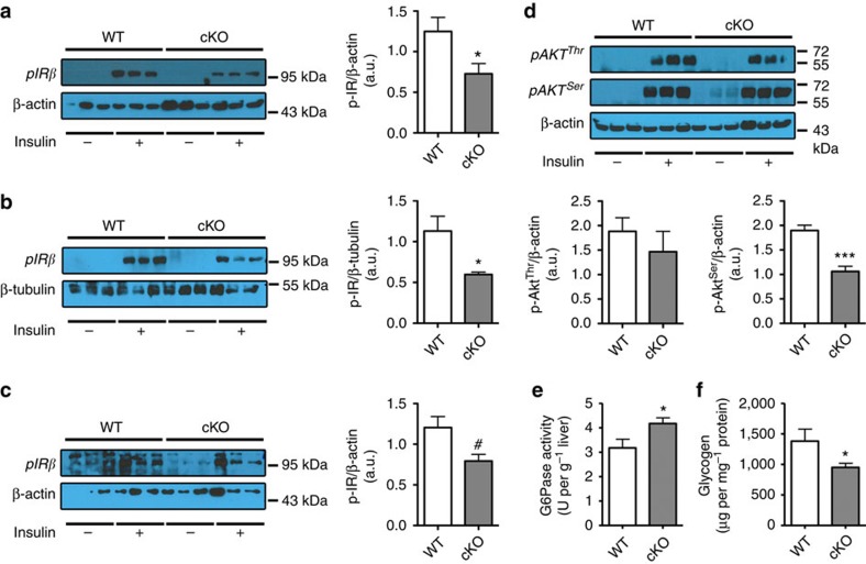 Adipose tissue Napepld deletion induces insulin resistance in the liver.(a) Representative liver immunoblots for p-IRβ and β-Actin in WT and cKO mice with or without insulin stimulation. Ratio of the insulin-stimulated p-IRβ in the liver on the loading control as measured by densitometry in cKO and WT mice (n=6). (b) Representative skeletal muscle immunoblots for p-IRβ and β-tubulin in WT and cKO mice with or without insulin stimulation. Ratio of the insulin-stimulated p-IRβ in the muscle on the loading control as measured by densitometry in cKO and WT mice (n=3–6). (c) Representative adipose tissue immunoblots, for p-IRβ and β-Actin in WT and cKO mice with or without insulin stimulation. Ratio of the insulin-stimulated p-IRβ in the adipose tissue on the loading control as measured by densitometry in cKO and WT mice (n=3). (d) Representative liver immunoblots for p-AktThr308, p-AktSer473 and β-Actin in WT and cKO mice with or without insulin stimulation. Ratio of the insulin-stimulated p-AktThr308 and p-AktSer473 in the liver on the loading control as measured by densitometry in cKO and WT mice (n=6). (e) Liver G6Pase activity (U per g liver) (n=6–10). (f) Liver glycogen content (μg per mg proteins; n=6–10). Data are presented as mean±s.e.m. Data with ‘*’ are significantly different (P<0.05), data with ‘***’ are significantly different (P<0.001), data with ‘#’ tend to be significantly different (P=0.06) according to the unpaired two-tailed Student t-test.