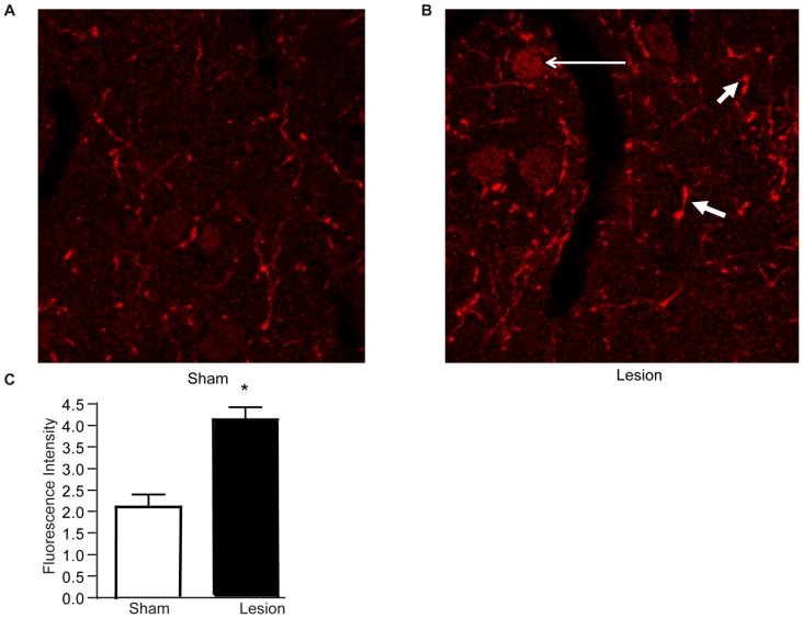 CB1R levels are increased in cortex of lesioned animals as visualized by immunohistochemistry. A,B A representative pair of images from studies examining the localization of CB1R by immunohistochemistry in layer II/III of PFC of sham and lesioned animals 14 days after surgery. Representative of 8 images taken per condition is shown. Scale bar = 20 µm. Increased CB1R immunoreactivity is indicated by short arrows and cell bodies are indicated by the long arrow. C, Quantification of changes in CB1R fluorescence intensity in PFC. Data represents mean fluorescence intensity from 16 images (4 per animal, n = 2 animals/group; p<0.05, t-test).