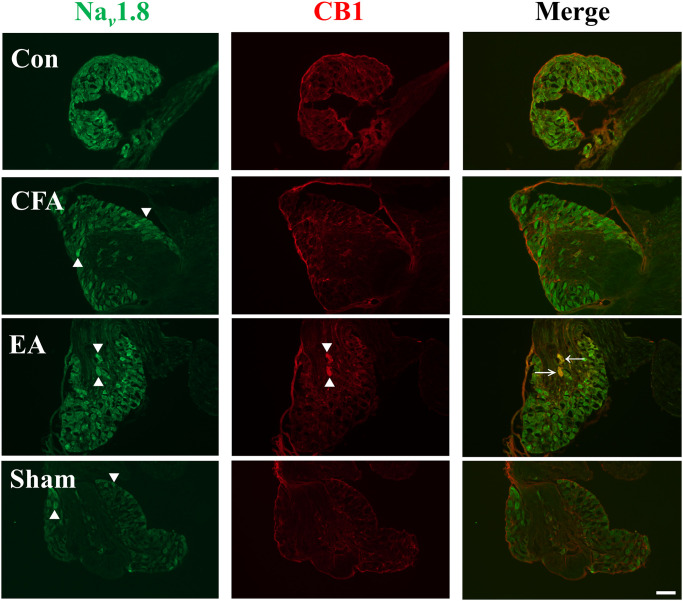 Nav 1.8 and CB1 expression was detected using dual immunofluorescence staining in the DRG.Nav 1.8 immunoreactive cells (green) and CB1 immunoreactive cells (red) were merged (yellow, marked by arrowhead). CFA injection increased expression of Nav 1.8 (marked by triangle) and EA raised expression of CB1 (marked by triangle) (scale bar = 100 μm, n = 3).