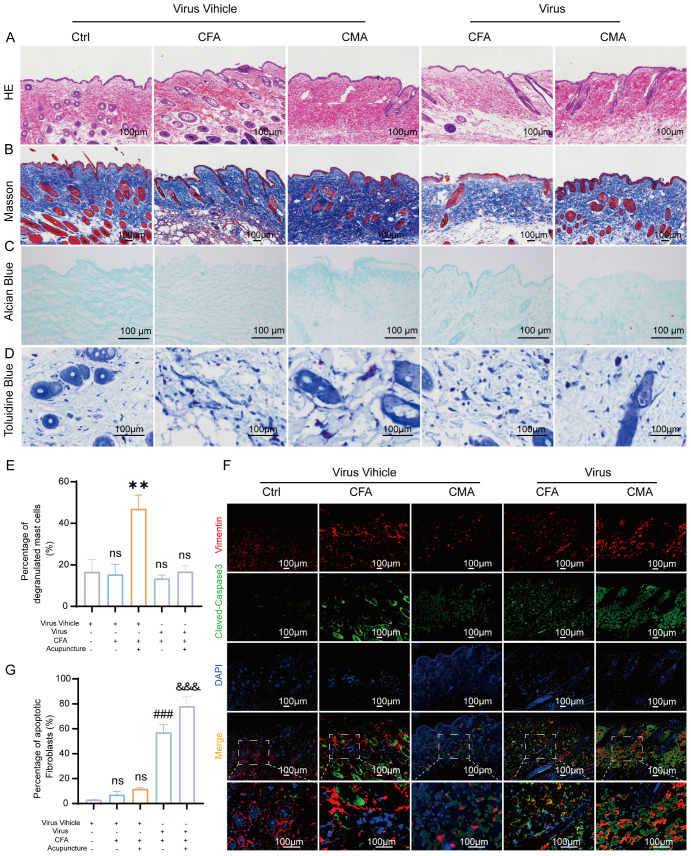 Histological and fluorescence images show skin sections under various conditions (Ctrl, CFA, CMA) with different staining techniques: hematoxylin and eosin, Masson's trichrome, Alcian blue, and toluidine blue. Staining highlights cellular structure and connective tissue. Bar graphs depict percentage changes in degranulated and apoptotic cells. Fluorescence microscopy displays vimentin, cleaved caspase, and DAPI staining with merged images, comparing virus vehicle and virus conditions. Scale bars indicate 100 micrometers.