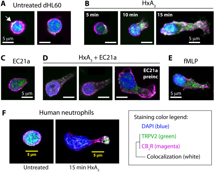 Cellular TRPV2 and CB2R distribution is altered in response to chemoattractant-induced polarization.Representative fluorescent microscopic images (single z planes) of dHL-60 cells demonstrating the subcellular location of TRPV2 (green) and CB2R (magenta) and their colocalization (white). Cells shown were treated for 15 min with (A) control buffer (HBSS+/+) or 285 nM HxA3 for (B) 5, 10, or 15 min. These cellular distributions of TRPV2 and CB2R were compared to dHL-60 cells treated for 15 min with a gradient of (C) 200 nM EC21a, (D) 200 nM EC21a plus 285 nM HxA3 simultaneously added or with 200 nM EC21a added 15 min before 285 nM HxA3 (right), and (E) 100 nM fMLP. Composite images use 4′,6-diamidino-2-phenylindole (DAPI) (blue) for nuclear staining. Scale bars, 5 μm.