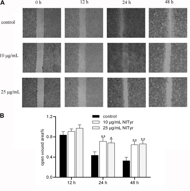 NITyr inhibited the migration ability of A549 cells. (A) The results of the control and experimental groups at 0 h, 12 h, 24 h, and 48 h were analyzed by using the wound healing assay. (B) Statistical analysis of the wound healing assay. The above experiment was conducted at least three times. *p < 0.05 and **p < 0.01 compared to the control group.