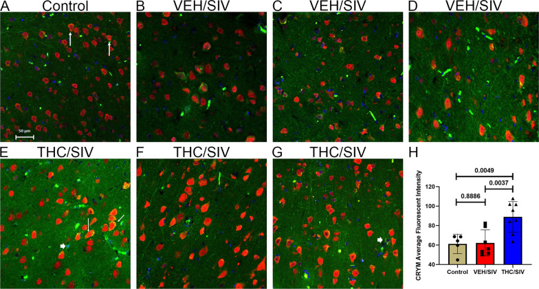 Chronic THC administration increased CRYM protein expression in the basal ganglia of chronically SIV-infected RMs. Basal ganglia tissues of uninfected control (A), VEH/SIV (B–D), and THC/SIV RMs (E–G) were immunostained for CRYM (green), NeuN (red), and DAPI for nuclear staining (blue). Note the significantly increased CRYM staining in NeuN+ neurons in the BG of THC/SIV (E–G) compared to VEH/SIV (B–D) and uninfected control RMs (A). A few NeuN− cells expressing CRYM protein were also detected (E and G, white arrowhead). Representative immunofluorescence images were captured using a Zeiss confocal microscope at 20X magnification. Yellow staining (A, E) indicates colocalization of CRYM to NeuN+ neurons (white arrow). Quantitation of CRYM (H) signal intensity was performed using Halo software. Differences in CRYM signal intensity between groups were analyzed using unpaired “t” tests after confirming data assumptions (normal distribution) employing the Prism v9 software (GraphPad software). A p-value of < 0.05 was considered significant
