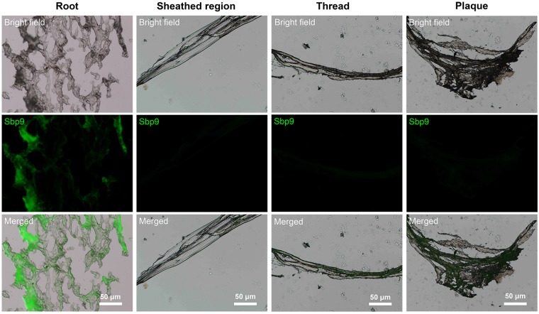 Immunohistochemical analysis demonstrates that Sbp9 is mainly located in the root.