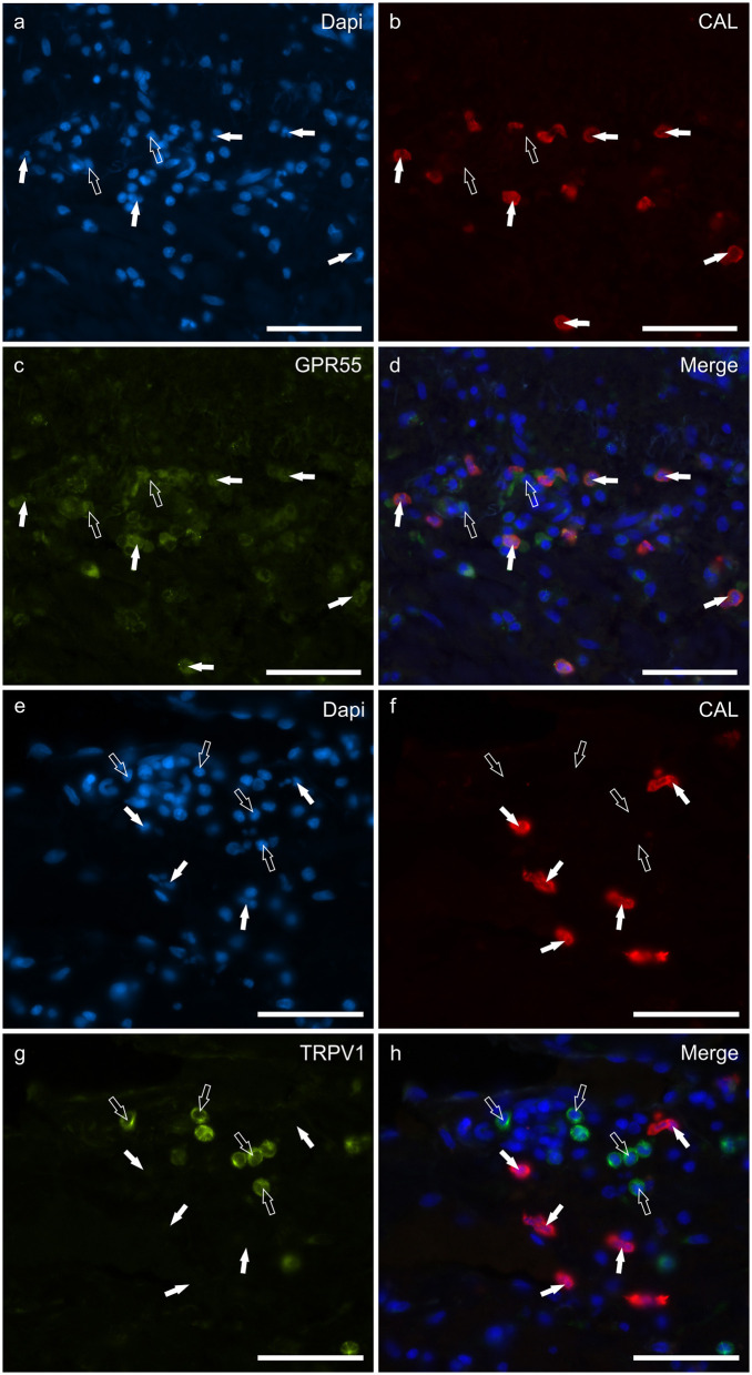 Photomicrographs of the cryosections of the skin of dogs with atopic dermatitis (AD) showing Calprotectin (CAL) immunoreactive cells expressing G-protein coupled receptor 55 (GPR55) (a–d) and transient receptor potential vanilloid 1 (TRPV1) immunoreactivity (IR) (e–h). (a–d) The white arrows indicate the Dapi-labeled nuclei of CAL positive cells co-expressing GPR55-IR (c). The open arrows indicate some CAL negative cells expressing GPR55-IR (c). (e–h) The white arrows indicate the Dapi-labeled nuclei of the CAL positive cells which were TRPV1 negative (g). The open arrows indicate some TRPV1-IR cells which were CAL negative (g). Bar: 50 μm.