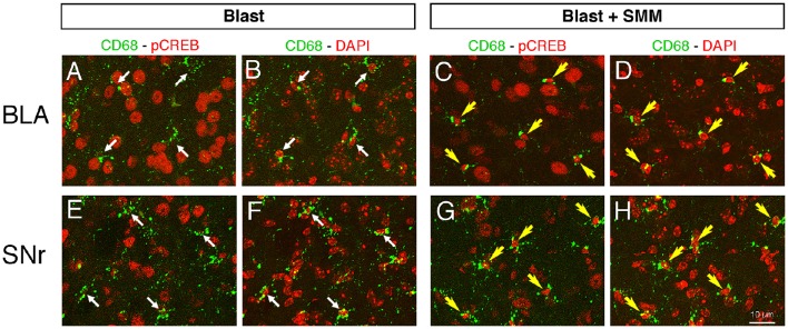 Images showing the effect of SMM-189 treatment on pCREB expression in microglia after blast. Confocal image pairs, one showing immunostaining for pCREB and CD68 and the other showing pCREB and DAPI, in left BLA and SNr in a blast alone mouse (A,B,E,F) compared to a SMM-189 treated blast mouse (C,D,G,H) at 3 days post blast. The CD68/pCREB double labeling shows microglia with CREB activation (i.e., nuclear pCREB; yellow arrows). The DAPI staining (pseudo-colored red for ease of viewing) reveals nuclei. Note that the nuclei of neurons are distinctly larger than those of microglia. The nuclei of all microglia in the blast mouse lack prominent pCREB (thin white arrows), whereas in the SMM-189 treated blast mouse all microglia are rich in nuclear pCREB (yellow arrows). Thus, SMM-189 treatment after blast results in CREB activation in microglia in BLA and SNr.