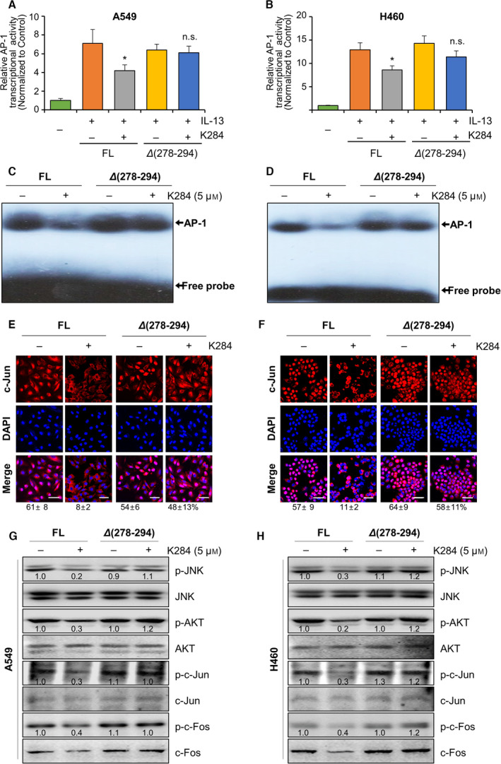 Abolished inhibitory effect of K284 on the activation of JNK/AP‐1 in mutant CHI3L1‐transfected A549 and H460 cells. (A, B) FL or Δ278‐294 mutants of human CHI3L1‐6× Myc‐expressing A549 cells and H460 cells were transfected with the AP‐1 luciferase vector for 6 h and then treated with IL‐13 with or without K284 for 24 h. Lane 1, empty vector‐expressing cells; lane 2, recombinant human IL‐13 (10 ng·mL−1)‐treated CHI3L1‐overexpressing cells; lane 3, recombinant human IL‐13 (10 ng·mL−1) and K284 (5 μm)‐treated CHI3L1‐overexpressing cells; lane 4, recombinant human IL‐13 (10 ng·mL−1)‐treated Δ278‐294 mutants of CHI3L1‐overexpressing cells; and lane 5, recombinant human IL‐13 (10 ng·mL−1) and K284 (5 μm)‐treated Δ278‐294 mutants of CHI3L1‐overexpressing cells. *P < 0.05 (vs. IL‐13 treatment). All error bars of graph reported are the standard deviation (SD) from three independent experiments. (C–H) FL or Δ278‐294 mutants of human CHI3L1‐6×Myc‐expressing A549 cells or H460 cells were treated with or without 5 μm K284. (C and D) Nuclear protein lysates were extracted and incubated together with AP‐1 consensus sequence labeled with γ‐32P‐ATP, and then, electrophoresis mobility shift assay was performed. (E and F) The translocation of c‐Jun from the cytosol to the nucleus was detected by confocal fluorescence microscopy. The percentage of c‐Jun‐positive cells were counted and shown below the images. Scale bar, 50 μm. (G and H) Western blot analysis for p‐JNK, JNK, p‐AKT, AKT, p‐c‐Jun, c‐Jun, p‐c‐Fos, and c‐Fos from A549 cells and H460 cells. Western blotting was repeated two times with duplicate samples. The values below the bands represent the band density.