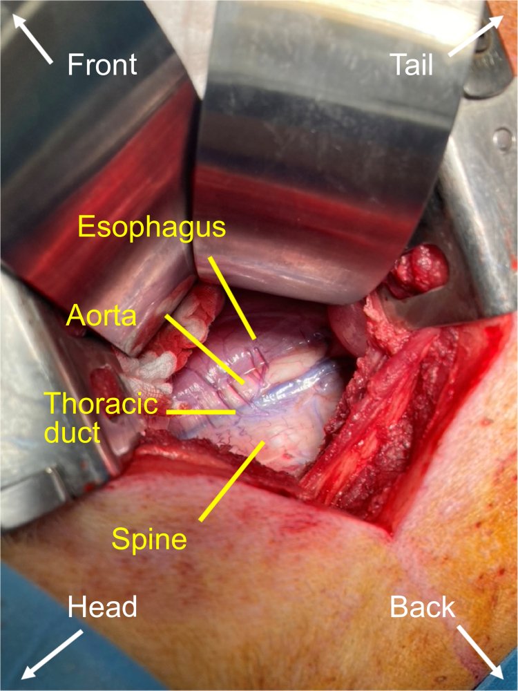 Topographic anatomy of the thoracic duct. The thorax was opened in the fourth intercostal space on the right side. The lung was pushed aside.